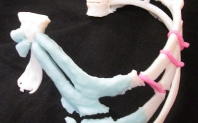 3D printing enhances chest wall reconstruction