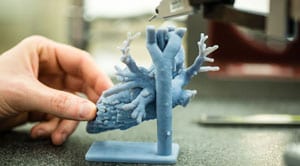 Reshaping the Healthcare Sector with 3D printing