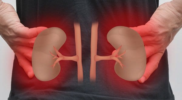 Bioprinting is One Step Closer to Making a Human Kidney