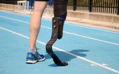 How 3D Printing Makes Complicated Medical Prosthetics a Possibility