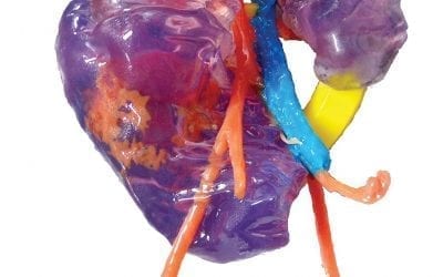 How Far Away Are We From 3D Printing Organs?