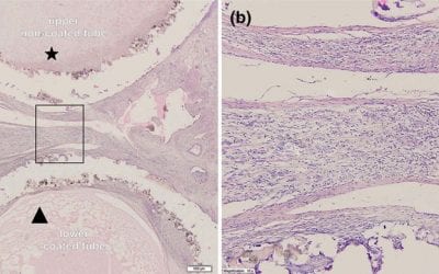 Polish Researchers 3D Printing Novel Holdfast Devices for Atrial Procedure