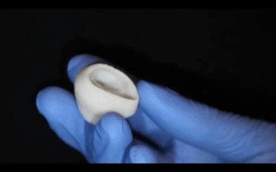 3D bioprinting breakthrough leads to full-scale, functioning heart parts