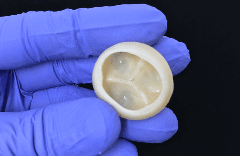 Carnegie Mellon researchers develop 3D printing for heart valves