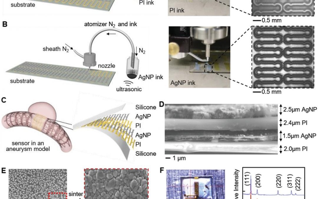 3D Printed Wireless Biosystems for Monitoring Cerebral Aneurysms in Real Time