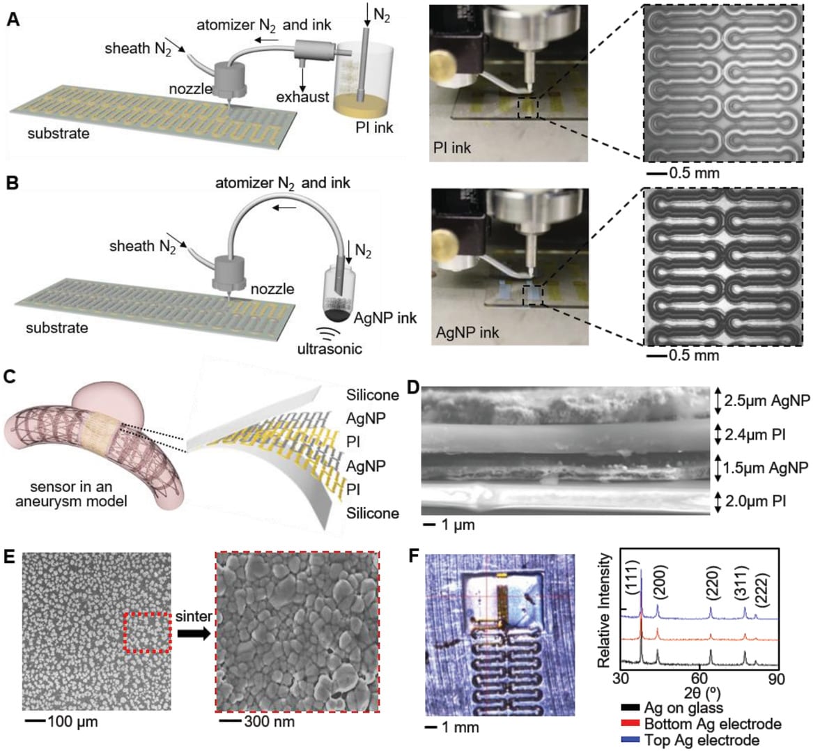 3D Printed Wireless Biosystems for Monitoring Cerebral Aneurysms in Real Time