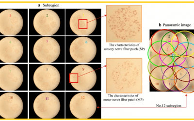 Chinese Researchers 3D Print Peripheral Nerves for Complex Study Using Enhanced Staining