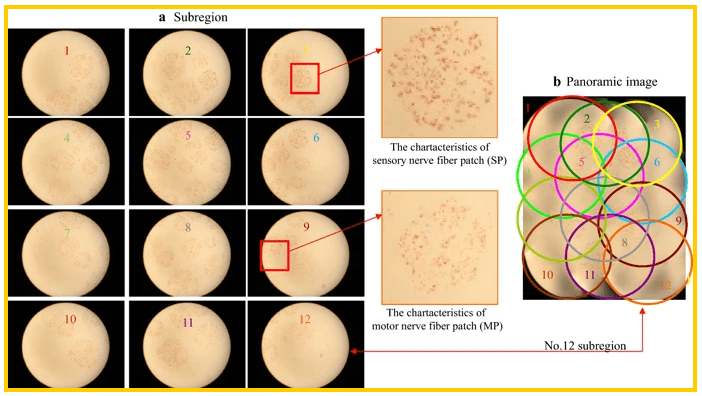 Chinese Researchers 3D Print Peripheral Nerves for Complex Study Using Enhanced Staining