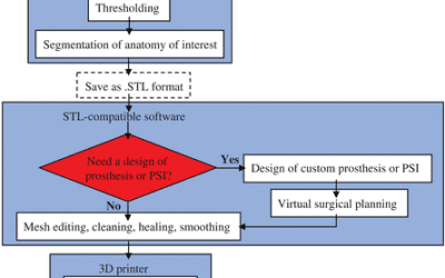 Exploring the Benefits of 3D Printing for Hip Joints