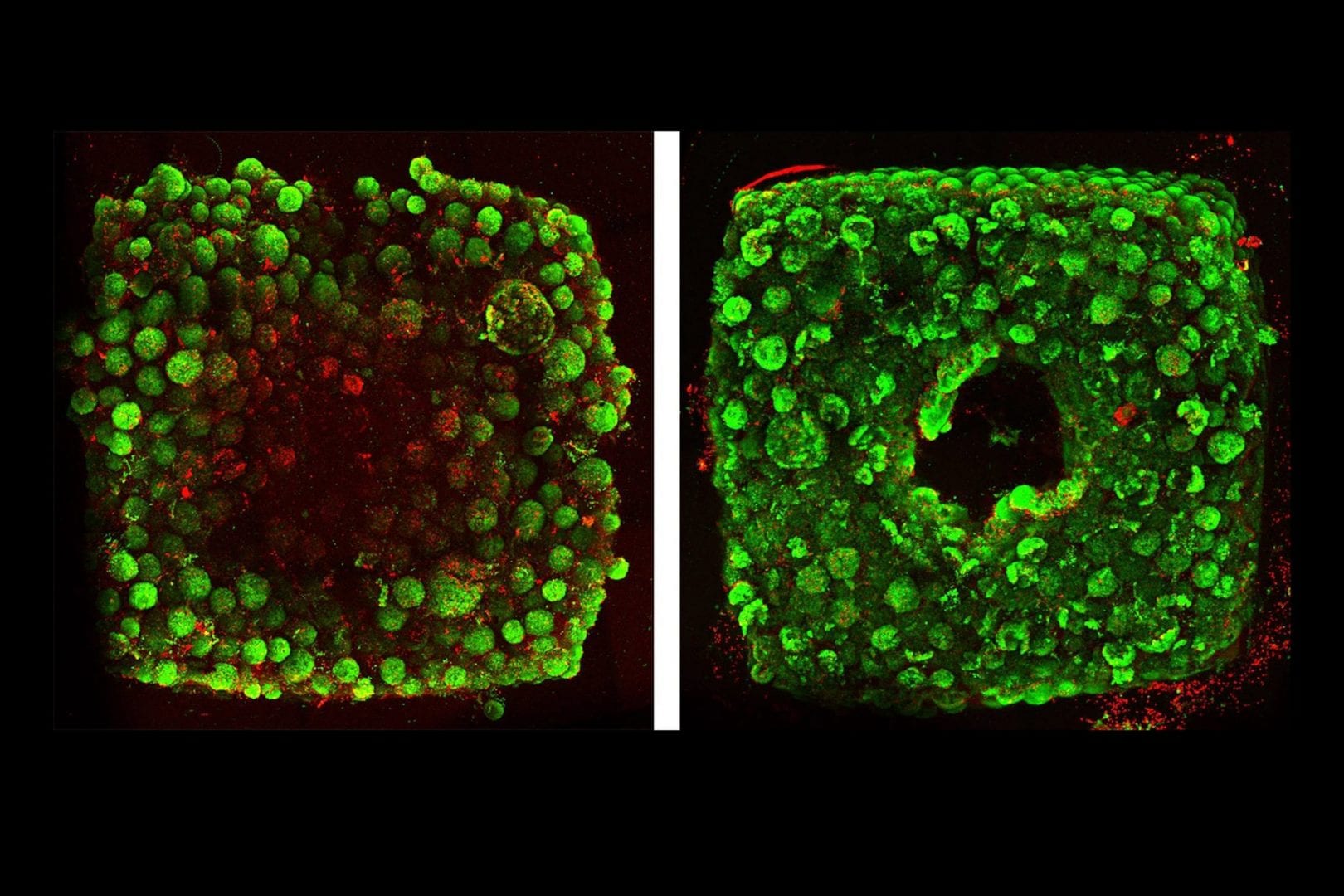 A SWIFTer way to build organs