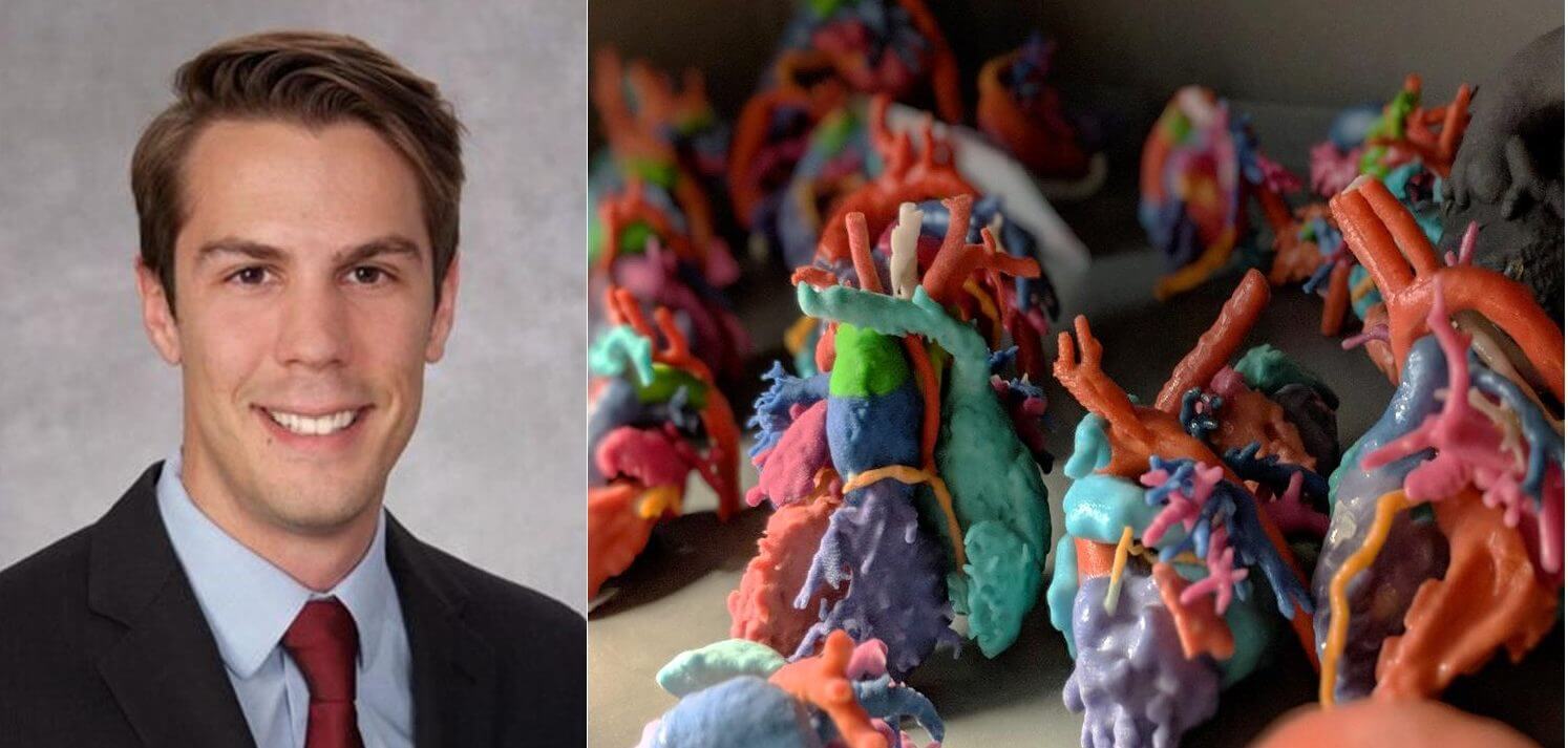 Justin Ryan of Rady Children’s Hospital on 3D Printing in Hospitals