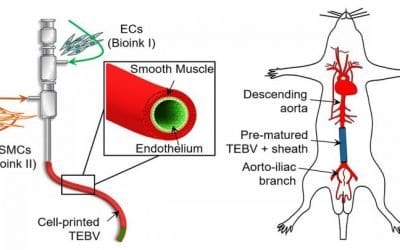 Innovations in 3D printing lead to implantable blood vessels