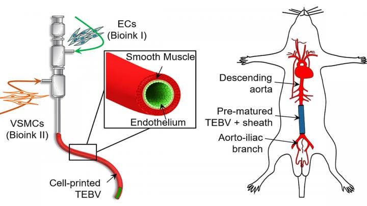 Innovations in 3D printing lead to implantable blood vessels