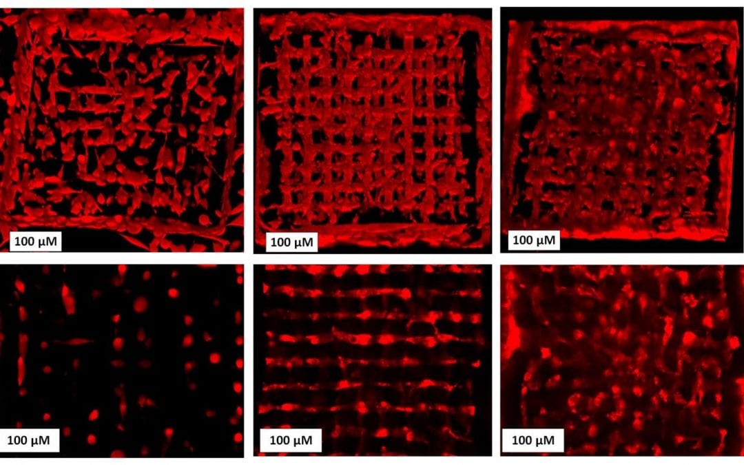 Bioprinting Living Cells Extremely Fast and at Very High Resolution in a 3D Printer