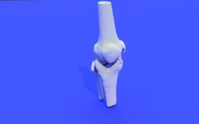 Top 10: Free Downloadable 3D Knee Model and Other STL Files