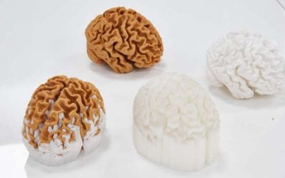 3D-printed models of the brain will help people understand dementia better