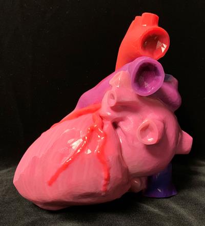 3 ways to advance 3D printing in radiology