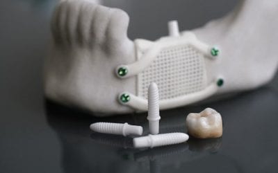 Ceramic 3D printing: A step beyond in dental products
