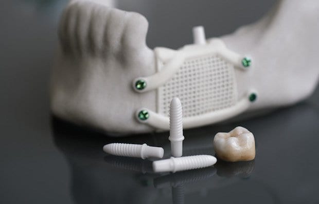 Ceramic 3D printing: A step beyond in dental products