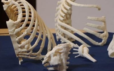 Use of 3D printing grows rapidly among orthopedic surgeons