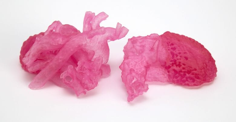 Henkel and NewPro3D team up for medical 3D printing solution