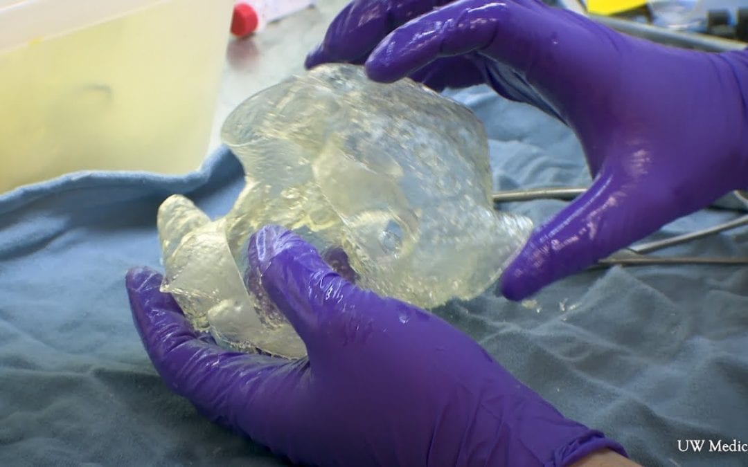 Personalized care, with 3D-printed heart models