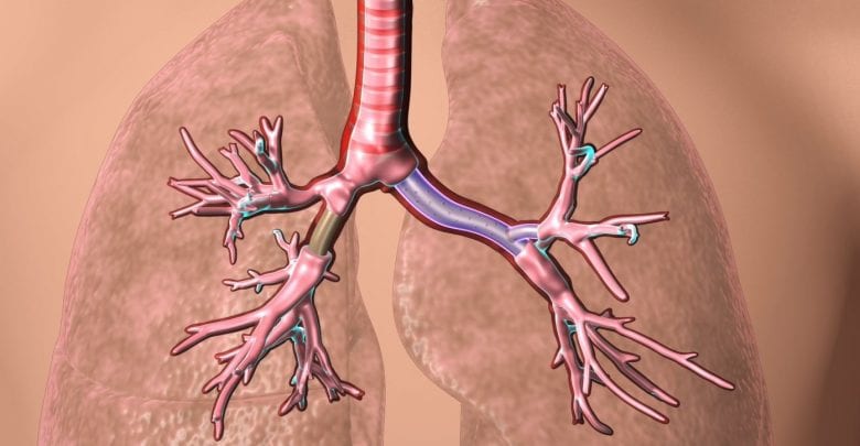 3D printed patient-specific airway stents approved by FDA