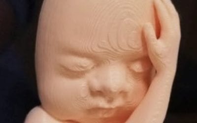 Can ultrasound, 3D printing deepen maternal-fetal bonds?