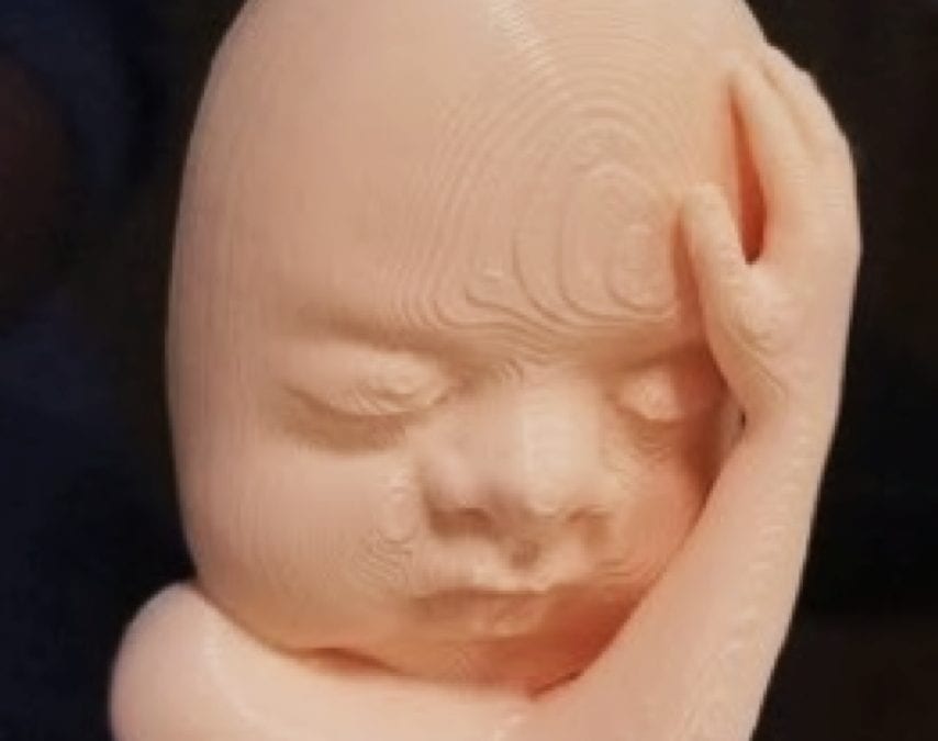 Can ultrasound, 3D printing deepen maternal-fetal bonds?
