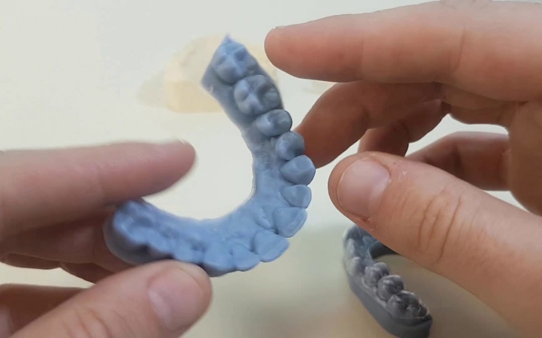 3D printing dental models: material comparison and tips