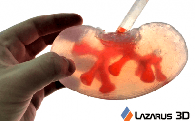 How medical device companies use AM for production today part 5: Lazarus 3D additive manufacturing