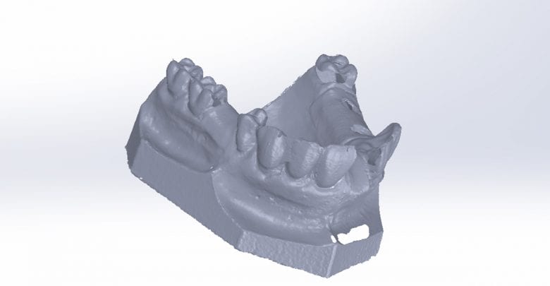 How medical device companies use AM for production today part 12: Medical 3D Design