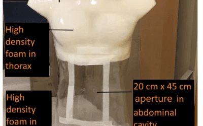 CASMER: Medical Imaging Mannequin Features 3D Printed Organ Models