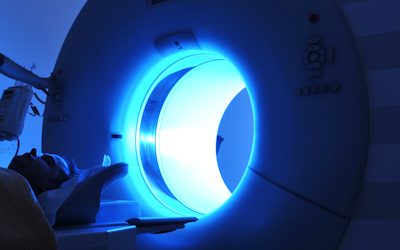 MRI effective for 3D printing of preop orbital plates