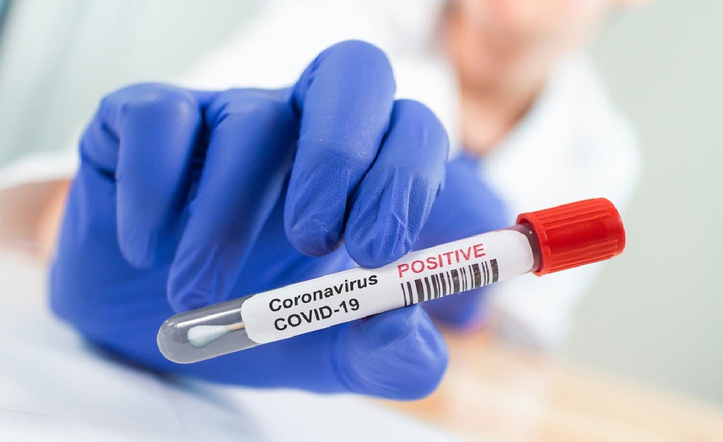 Desperate hospitals are creating their own coronavirus test swabs with 3D printing