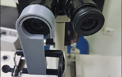 3D Printing in Ophthalmology: Smartphone Slit-Lamp Adapter for Diagnostics