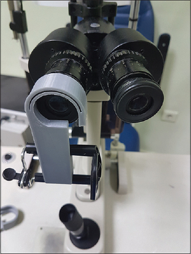 3D Printing in Ophthalmology: Smartphone Slit-Lamp Adapter for Diagnostics