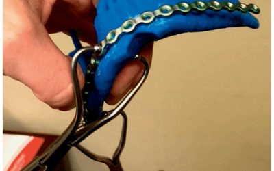 Plastic Surgery: 3D Printed Patient-Specific Applications for Craniomaxillofacial Operations