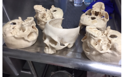 3D Printed FibreTuff Medical Models Are Bone-Like & Anatomically Correct