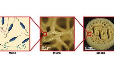 3D-printed ‘cartilage’ could be used for spinal implants