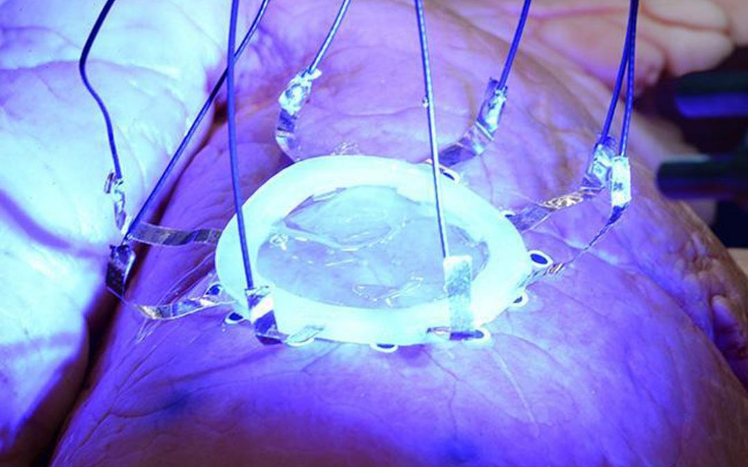 See how researchers 3D-print a soft medical sensor on an expanding lung