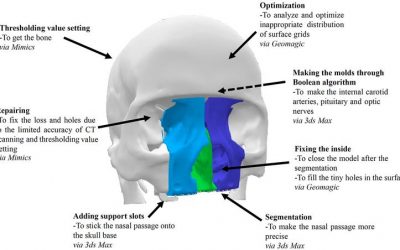 3D-Printed Models for Training & Planning of Endoscopic Pituitary Surgery