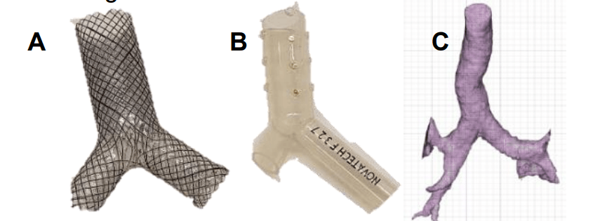 Lung Cancer Treatment: 3D Printing Molds for Personalized Airway Stents