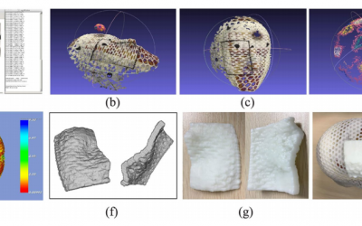 Improving Medication Delivery Boluses with an iPhone & Desktop 3D Printer