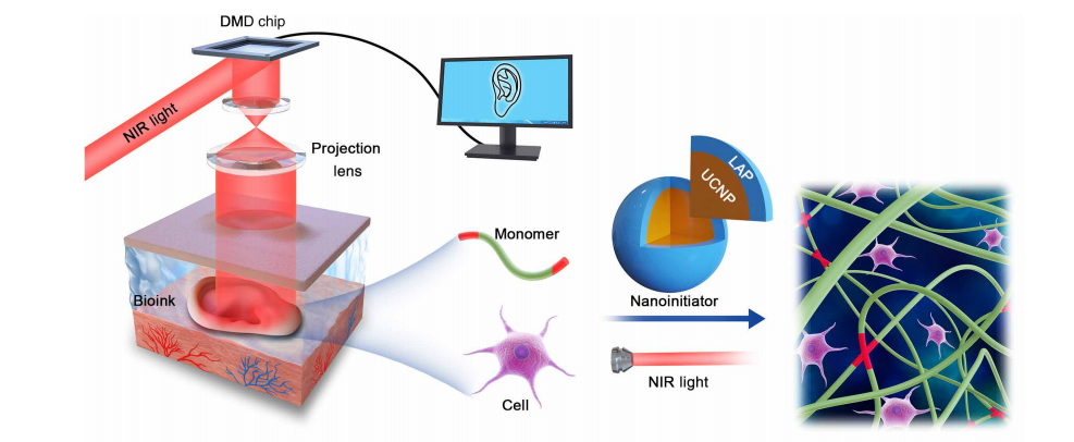 In Vivo Bioprinting Made Possible with Digital Near-infrared Photopolymerization