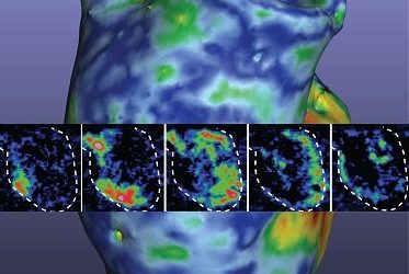 Light Helps Pump Life into Heart Muscle