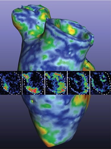 Light Helps Pump Life into Heart Muscle