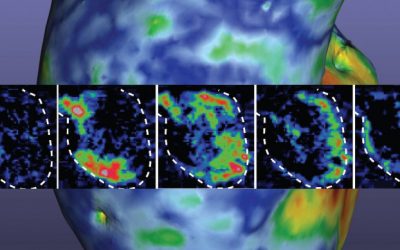 Scientists 3D Print a Functioning Heart Pump Made of Human Cells