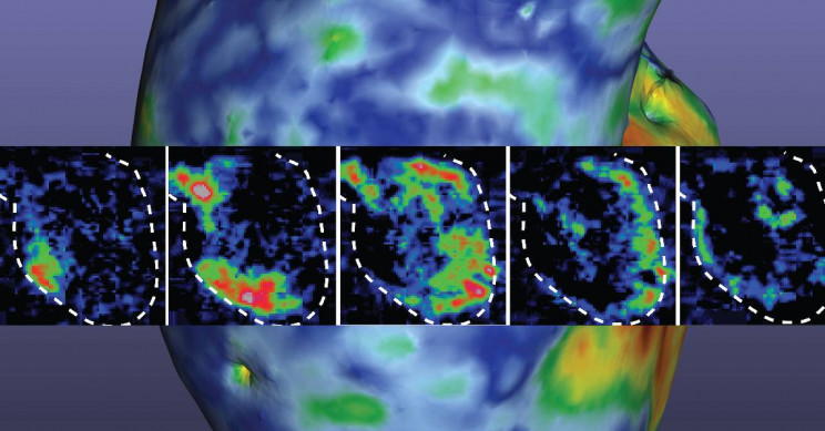 Scientists 3D Print a Functioning Heart Pump Made of Human Cells