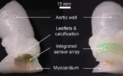 In a first, researchers 3D print lifelike heart valve models